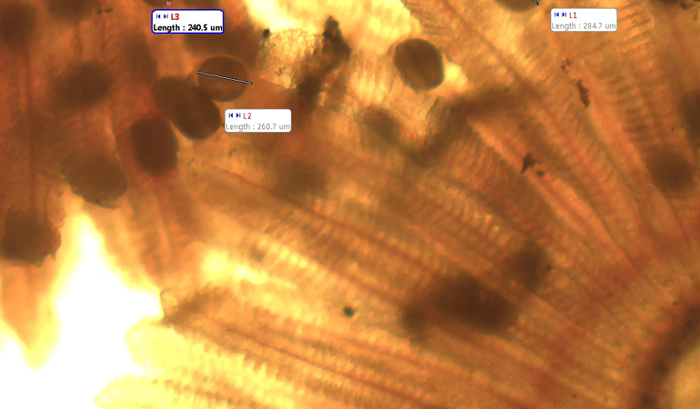 Microscopic image of Glochidia fish parasite Microscopic image of Glochidia fish parasite